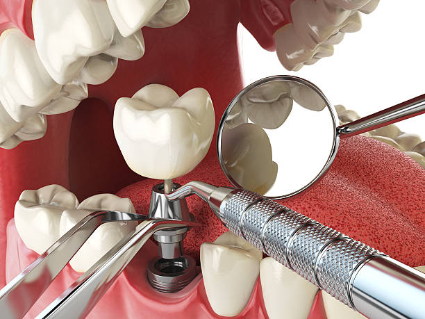 Best Broken or Cracked Tooth Emergency Dentist in Glasgow Village, MO